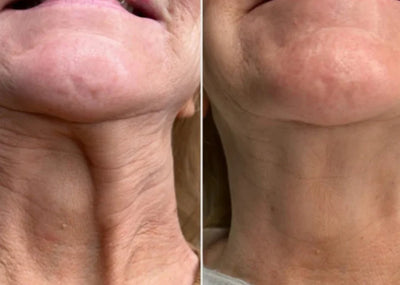 Velora™ | Anti-Rimpel- en Oogserum. Direct Effect in 3 Minuten