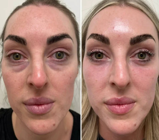 Velora™ | Anti-Rimpel- en Oogserum. Direct Effect in 3 Minuten