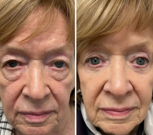 Velora™ | Anti-Rimpel- en Oogserum. Direct Effect in 3 Minuten