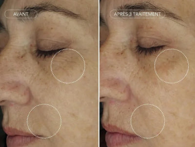 Velora™ | Anti-Rimpel- en Oogserum. Direct Effect in 3 Minuten