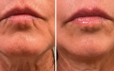 Velora™ | Anti-Rimpel- en Oogserum. Direct Effect in 3 Minuten