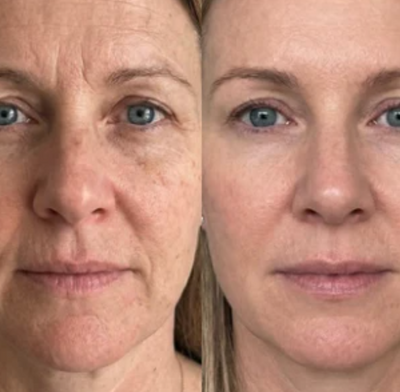 Velora PDRN Collagen Volume Balm
